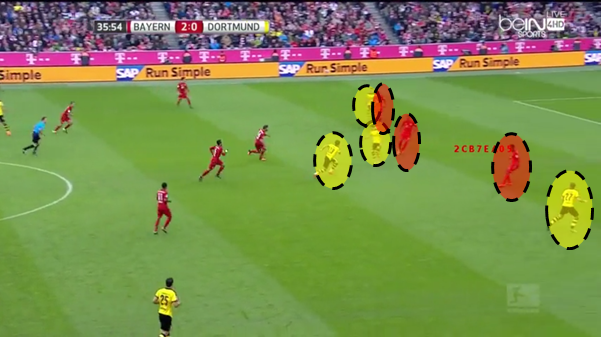 Dortmund attack create 4v3